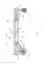 Fig. 14 - Transformative hand cart