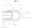 Fig. 03 - Rack-and-pinion steering gear unit