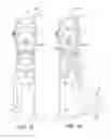 Fig. 16 - Bicycle control device