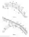 Fig. 06 - Chainring