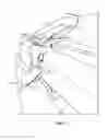 Fig. 06 - Garbage can retention clip
