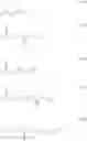 Fig. 132 - Salt, resin, resist composition and method for producing resist pattern
