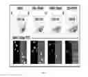 Fig. 13 - Compositions and methods for cancer detection and treatment