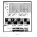 Fig. 21 - Compositions and methods for cancer detection and treatment