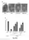 Fig. 09 - Compounds and methods for myotonic dystrophy therapy