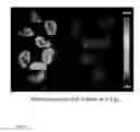 Fig. 05 - Radiolabeled cationic steroid antimicrobials and diagnostic methods