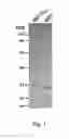 Fig. 02 - BONE DELIVERY CONJUGATES AND METHOD OF USING SAME TO TARGET PROTEINS TO BONE
