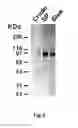 Fig. 06 - BONE DELIVERY CONJUGATES AND METHOD OF USING SAME TO TARGET PROTEINS TO BONE
