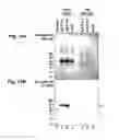 Fig. 15 - BONE DELIVERY CONJUGATES AND METHOD OF USING SAME TO TARGET PROTEINS TO BONE