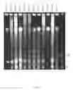 Fig. 05 - Toxins in type A 