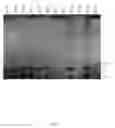 Fig. 06 - Toxins in type A 