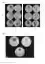 Fig. 07 - Antimicrobial protein