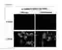 Fig. 28 - Composition comprising at least two influenza A virus-neutralizing-binding molecules