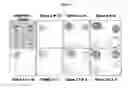 Fig. 03 - Uses of antibodies directed against amyloid-β
