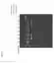 Fig. 49 - Methods of inhibiting complement C4 activation with anti-complement C1s antibodies
