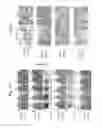 Fig. 11 - Compositions and methods for treating HIF-1α over-expressing cancers