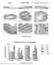 Fig. 55 - Antibodies that bind to TL1A and methods of treating inflammatory or autoimmune disease comprising administering such antibodies