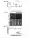 Fig. 02 - Methods for preserving the viability of retinal ganglion cells in patients with glaucoma by an anti-TNF receptor 2 (anti-TNFR2) antibody