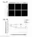 Fig. 03 - Methods for preserving the viability of retinal ganglion cells in patients with glaucoma by an anti-TNF receptor 2 (anti-TNFR2) antibody