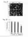 Fig. 05 - Methods for preserving the viability of retinal ganglion cells in patients with glaucoma by an anti-TNF receptor 2 (anti-TNFR2) antibody