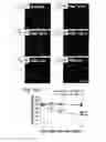 Fig. 06 - Methods for preserving the viability of retinal ganglion cells in patients with glaucoma by an anti-TNF receptor 2 (anti-TNFR2) antibody