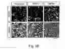 Fig. 09 - Methods for preserving the viability of retinal ganglion cells in patients with glaucoma by an anti-TNF receptor 2 (anti-TNFR2) antibody