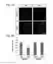Fig. 11 - Methods for preserving the viability of retinal ganglion cells in patients with glaucoma by an anti-TNF receptor 2 (anti-TNFR2) antibody