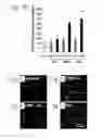 Fig. 13 - Methods for preserving the viability of retinal ganglion cells in patients with glaucoma by an anti-TNF receptor 2 (anti-TNFR2) antibody