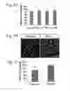 Fig. 14 - Methods for preserving the viability of retinal ganglion cells in patients with glaucoma by an anti-TNF receptor 2 (anti-TNFR2) antibody