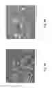 Fig. 10 - Methods for enhancing propped fracture conductivity
