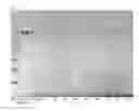 Fig. 10 - METHODS AND COMPOSITIONS FOR INCREASING TOXIN PRODUCTION