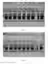Fig. 03 - Methods of cell separation