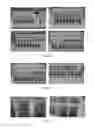 Fig. 07 - Methods of cell separation