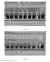 Fig. 12 - Methods of cell separation