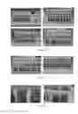 Fig. 16 - Methods of cell separation