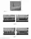 Fig. 17 - Methods of cell separation