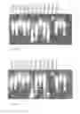 Fig. 10 - THERMOSTABLE NUCLEASE