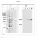 Fig. 07 - Thermostable cellobiohydrolase
