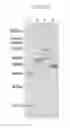 Fig. 28 - Thermostable cellobiohydrolase