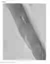 Fig. 03 - Hatching fluid enzymes and uses thereof
