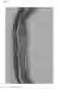Fig. 04 - Hatching fluid enzymes and uses thereof