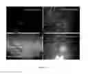 Fig. 11 - MATRIX METALLOPROTEINASSES AND USES THEREOF