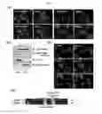 Fig. 11 - Composition for controlling stem cells pluripotency, containing LIN28A methylation inhibitor, and method for screening for LIN28A methylation inhibitor