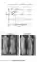 Fig. 23 - Antiproliferative agent