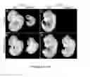 Fig. 06 - Enhanced Expression Of RNA Vectors