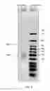Fig. 03 - Ligase-assisted nucleic acid circularization and amplification