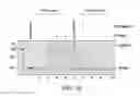 Fig. 15 - Ligase-assisted nucleic acid circularization and amplification