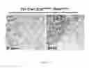 Fig. 13 - MARKERS OF ENDOTHELIAL PROGENITOR CELLS AND USES THEREOF