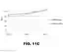 Fig. 21 - Compositions and methods for detecting cancer metastasis