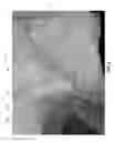 Fig. 11 - Woven multi-layer fabrics and methods of fabricating same